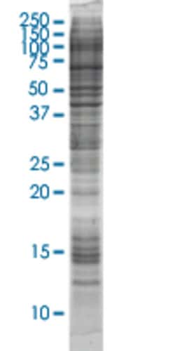 Abnova ARMC8 HEK293 Cell Transient Overexpression Lysate (Nondenatured) 100 &mu;g | Buy Online | Abnova&trade; | Fisher Scientific