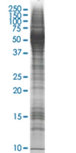 Abnova™ ABHD5 HEK293 Cell Transient Overexpression Lysate (Nondenatured)
