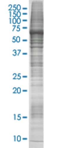 Abnova™ CHD4 HEK293 Cell Transient Overexpression Lysate (Nondenatured)