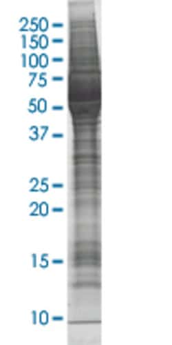 Abnova BUB1 HEK293 Cell Transient Overexpression Lysate (Nondenatured) 100 &mu;g | Buy Online | Abnova&trade; | Fisher Scientific