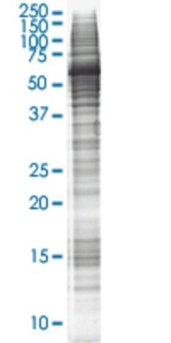 Abnova C20orf64 HEK293 Cell Transient Overexpression Lysate (Nondenatured) 100&mu;g | Buy Online | Abnova&trade; | Fisher Scientific