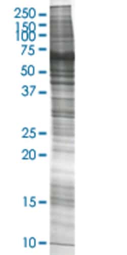 Abnova BAIAP2 HEK293 Cell Transient Overexpression Lysate (Nondenatured) 100 &mu;g | Buy Online | Abnova&trade; | Fisher Scientific