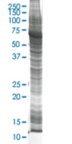 Abnova CTH HEK293 Cell Transient Overexpression Lysate (Nondenatured) 100 &mu;g | Buy Online | Abnova&trade; | Fisher Scientific