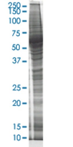 Abnova CSTB HEK293 Cell Transient Overexpression Lysate (Nondenatured) 100 &mu;g | Buy Online | Abnova&trade; | Fisher Scientific