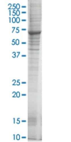 Abnova DSU HEK293 Cell Transient Overexpression Lysate (Nondenatured) 100 &mu;g | Buy Online | Abnova&trade; | Fisher Scientific