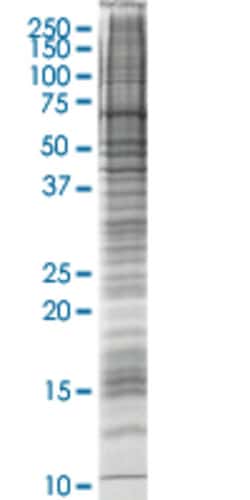 Abnova™ ASAH1 HEK293 Cell Transient Overexpression Lysate (Nondenatured)