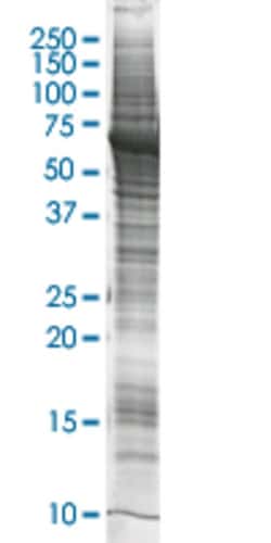 Abnova™ BIRC4 HEK293 Cell Transient Overexpression Lysate (Nondenatured)