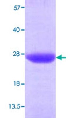 Abnova Human VPS28 (NP_057292, 1 a.a. - 221 a.a.) Full-length Recombinant Protein 100 &mu;g | Buy Online | Abnova&trade; | Fisher Scientific