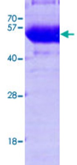 Abnova Human SEPSECS (NP_058651, 1 a.a. - 501 a.a.) Full-length Recombinant Protein with His tag 100 &mu;g | Buy Online | Abnova&trade; | Fisher Scientific