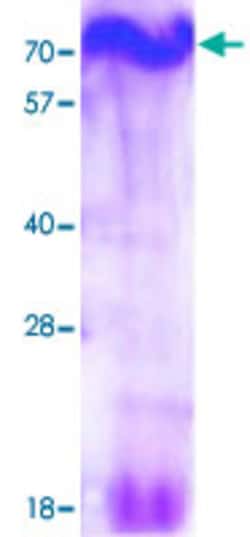 Abnova™ Human C16orf53 (NP_078792, 1 a.a. - 254 a.a.) Full-length Recombinant Protein with His tag