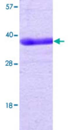 Abnova Human PTPN1 (NP_002818, 1 a.a. - 321 a.a.) Partial Recombinant Protein 100&mu;g | Buy Online | Abnova&trade; | Fisher Scientific