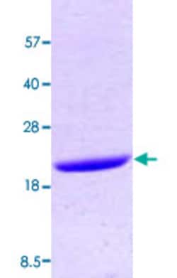 Abnova Human PPIA (NP_066953, 1 a.a. - 165 a.a.) Full-length Recombinant Protein 100 &mu;g | Buy Online | Abnova&trade; | Fisher Scientific