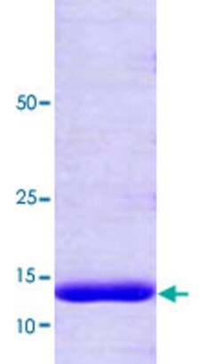 Abnova Human PPIH (NP_006338, 1 a.a. - 177 a.a.) Full-length Recombinant Protein 100 &mu;g | Buy Online | Abnova&trade; | Fisher Scientific