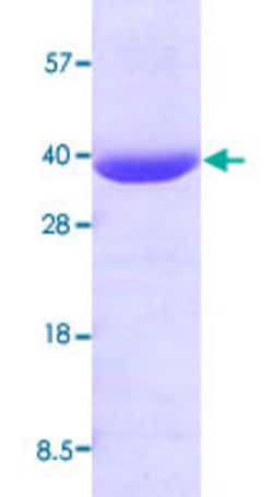 Abnova Human AKR1B1 (NP_001619, 1 a.a. - 316 a.a.) Full-length Recombinant Protein 100 &mu;g | Buy Online | Abnova&trade; | Fisher Scientific