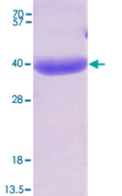 Abnova Human AKR1B10 (NP_064695, 1 a.a. - 316 a.a.) Full-length Recombinant Protein 100 &mu;g | Buy Online | Abnova&trade; | Fisher Scientific