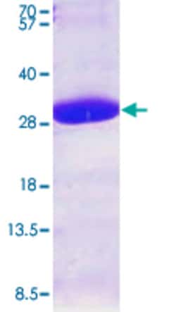 Abnova Human PRDX6 (NP_004896, 1 a.a. - 224 a.a.) Full-length Recombinant Protein with His tag 100 &mu;g | Buy Online | Abnova&trade; | Fisher Scientific