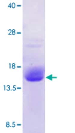 Abnova Human FKBP2 (NP_001128680, 22 a.a. - 142 a.a.) Partial Recombinant Protein 50 &mu;g | Buy Online | Abnova&trade; | Fisher Scientific