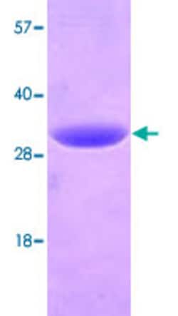 Abnova Human YWHAH (NP_003396, 1 a.a. - 246 a.a.) Full-length Recombinant Protein with His tag 100 &mu;g | Buy Online | Abnova&trade; | Fisher Scientific