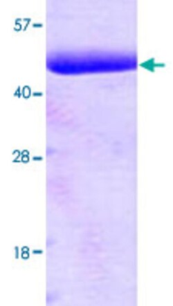 Abnova Human PDK1 (NP_002601, 29 a.a. - 436 a.a.) Partial Recombinant Protein 100 &mu;g | Buy Online | Abnova&trade; | Fisher Scientific