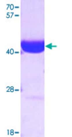Abnova Human PARP1 (AAH37545, 662 a.a. - 1014 a.a.) Partial Recombinant Protein 100 &mu;g | Buy Online | Abnova&trade; | Fisher Scientific
