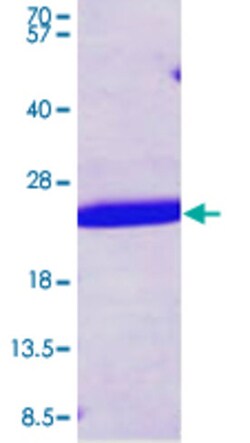 Abnova Human SHH (NP_000184, 24 a.a. - 197 a.a.) Partial Recombinant Protein with His tag 100 &mu;g | Buy Online | Abnova&trade; | Fisher Scientific