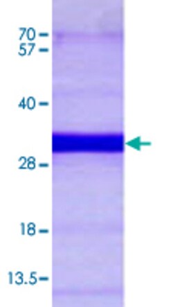 Abnova Human RAB21 (NP_055814, 18 a.a. - 222 a.a.) Partial Recombinant Protein with His tag 50 &mu;g | Buy Online | Abnova&trade; | Fisher Scientific