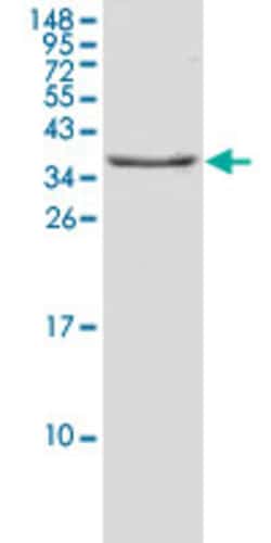Abnova Human IL1R1 (NP_003847.2, 19 a.a. - 328 a.a.) Partial Recombinant Protein 10 &mu;g | Buy Online | Abnova&trade; | Fisher Scientific