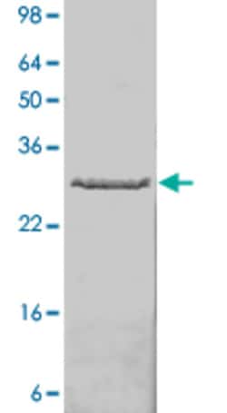 Abnova Human FLT1 (NP_002010.1, 31 a.a. - 328 a.a.) Partial Recombinant Protein 10 &mu;g | Buy Online | Abnova&trade; | Fisher Scientific