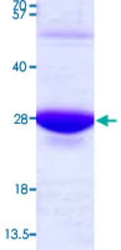 Abnova Human GPX1 (NP_000572, 1 a.a. - 203 a.a., U49C) Full-length Recombinant Protein with His tag 100 &mu;g | Buy Online | Abnova&trade; | Fisher Scientific