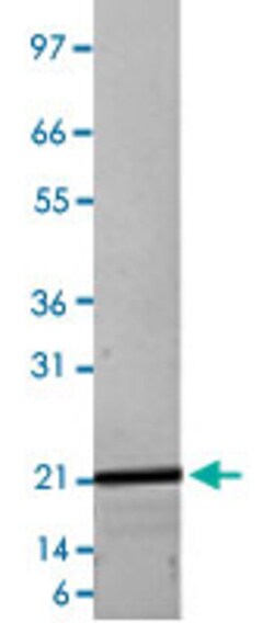 Abnova Human FGF22 (Q9HCT0) Recombinant Protein 20&mu;g | Buy Online | Abnova&trade; | Fisher Scientific