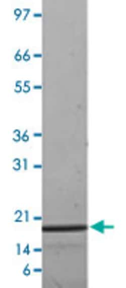 Abnova Human IL19 (Q9UHD0) Recombinant Protein 10 &mu;g | Buy Online | Abnova&trade; | Fisher Scientific