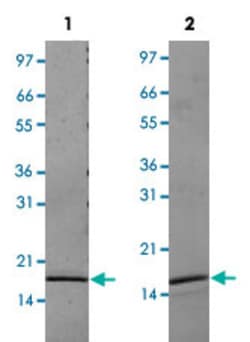 Abnova Human IL20 (Q9NYY1) Recombinant Protein 10 &mu;g | Buy Online | Abnova&trade; | Fisher Scientific