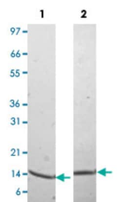Abnova Human IL2 (P60568) Recombinant Protein 50 &mu;g | Buy Online | Abnova&trade; | Fisher Scientific