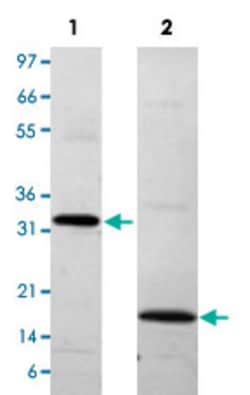 Abnova Human PDGFA (P04085) Recombinant Protein 10 &mu;g | Buy Online | Abnova&trade; | Fisher Scientific