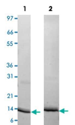 Abnova Human Procalcitonin Recombinant Protein 10&mu;g | Buy Online | Abnova&trade; | Fisher Scientific
