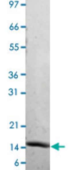Abnova Human IL22 (Q9GZX6) Recombinant Protein 10 &mu;g | Buy Online | Abnova&trade; | Fisher Scientific