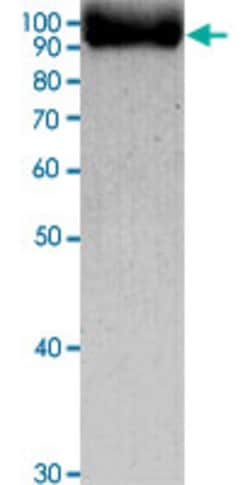 Abnova&trade;&nbsp;Human MMP9 native Protein from human blood