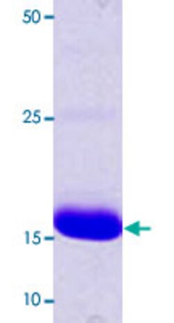 Abnova dnaK (Escherichia coli) Recombinant Protein 100 &mu;g | Buy Online | Abnova&trade; | Fisher Scientific