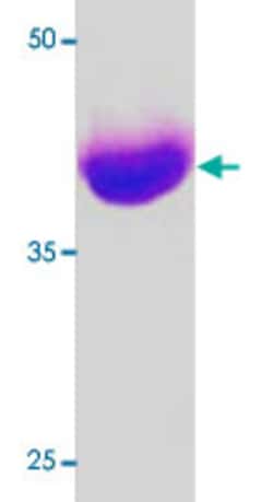 Abnova dnaK (Escherichia coli) Recombinant Protein 100 &mu;g | Buy Online | Abnova&trade; | Fisher Scientific