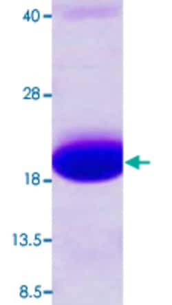Abnova skp (Escherichia coli) Recombinant Protein 100&mu;g | Buy Online | Abnova&trade; | Fisher Scientific