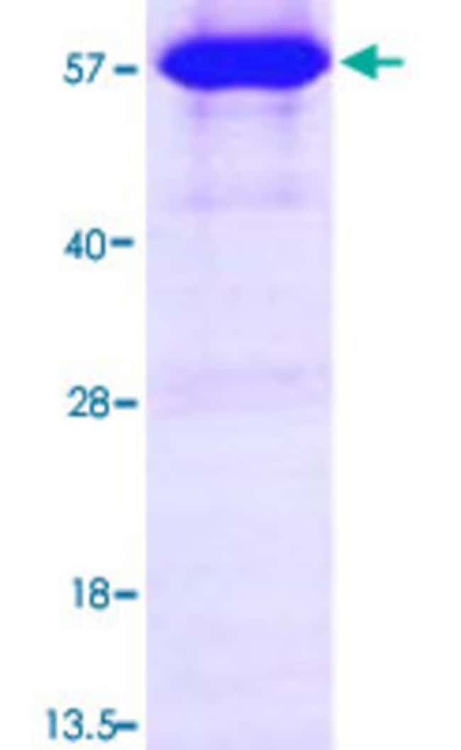 Abnova Firefly Luciferase (BAF48390, 1 a.a. 550 a.a.) Fulllength Fisher Scientific