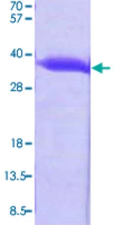 Abnova hchA (Escherichia coli) Recombinant Protein 100 &mu;g | Buy Online | Abnova&trade; | Fisher Scientific