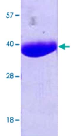 Abnova nanA (Escherichia coli) Recombinant Protein 100 &mu;g | Buy Online | Abnova&trade; | Fisher Scientific