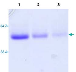 Abnova Human TNFRSF10A (1 a.a. - 238 a.a.) from HEK 293 cells with human IgG1 Recombinant Protein 50&mu;g | Buy Online | Abnova&trade; | Fisher Scientific