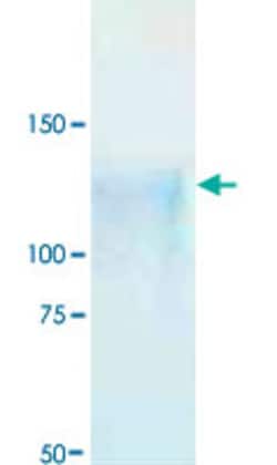 Abnova gp120 (pCAAN5342) (HIV-1/Clade B) (AY835452, 34 a.a. - 518 a.a.) Partial Recombinant Protein with His tag expressed in 293 cells 50 &mu;g | Buy Online | Abnova&trade; | Fisher Scientific