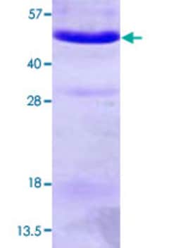 Abnova Human ANXA7 (NP_001147, 1 a.a. - 466 a.a. ) Full-length Recombinant Protein with His tag 100 &mu;g | Buy Online | Abnova&trade; | Fisher Scientific