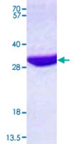 Abnova Human EMG1 (NP_006322, 1 a.a. - 244 a.a.) Full-length Recombinant Protein with His tag 100 &mu;g | Buy Online | Abnova&trade; | Fisher Scientific