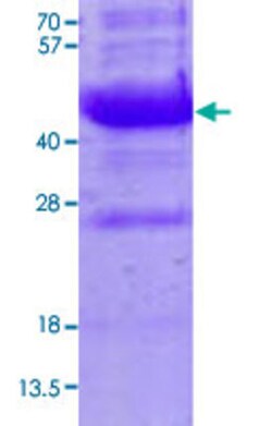 Abnova Human NEU1 (NP_000425, 48 a.a. - 415 a.a.) Partial Recombinant Protein with His tag 100 &mu;g | Buy Online | Abnova&trade; | Fisher Scientific