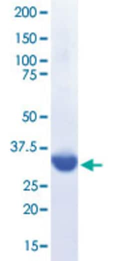 Abnova Human GP1BA (NP_000164, 17 a.a - 306 a.a) Partial Protein (single sulfated form) with C-terminal hexahistidine tag expressed in HEK293EBNA1 cells 45 &mu;g | Buy Online | Abnova&trade; | Fisher Scientific
