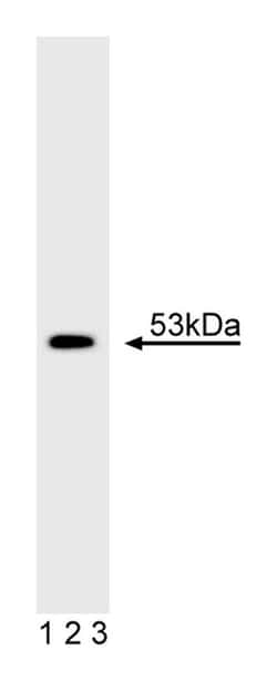 p53 Mouse, Unlabeled, Clone: PAB 122, BD 0.1mg; Unlabeled:Antibodies, Polyclonal